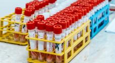 Photo: Stock photo of blood test. Colourbox.